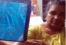 ਸਰਜਰੀ ਤੋਂ 5 ਸਾਲ ਬਾਅਦ ਔਰਤ ਦੇ ਪੇਟ `ਚੋਂ ਮਿਲਿਆ ਸਰਜੀਕਲ ਔਜ਼ਾਰ surgery