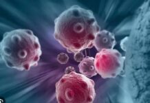 ਕੈਂਸਰ ਵਰਗੀ ਭਿਆਨਕ ਬਿਮਾਰੀ ਤੋਂ ਬਚਣਾ ਹੈ ਜਿ਼ੰਦਗੀ ਜਿਊਣ ਤੇ ਬਦਲੋ ਤਰੀਕੇ cancer