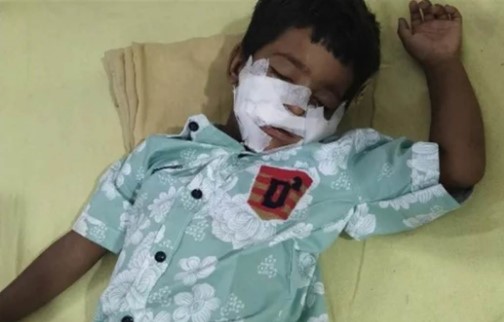 Injured Child Injured Child