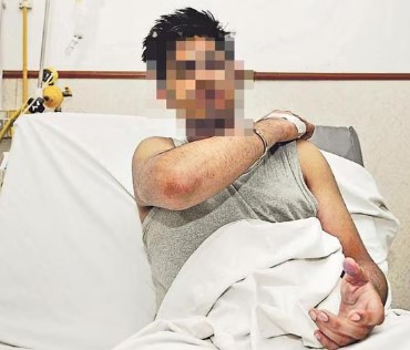 Injured Student Injured Student