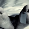 Dead Body