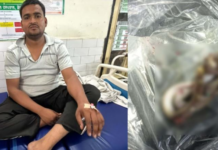 ਡੰਗ ਮਾਰਨ ਵਾਲੇ ਸੱਪ ਨੂੰ ਨੌਜਵਾਨ ਨੇ ਮਾਰ ਮੁਕਾਇਆ Snake Bite